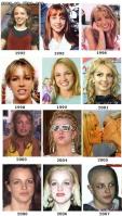 Britney Spears condition overview