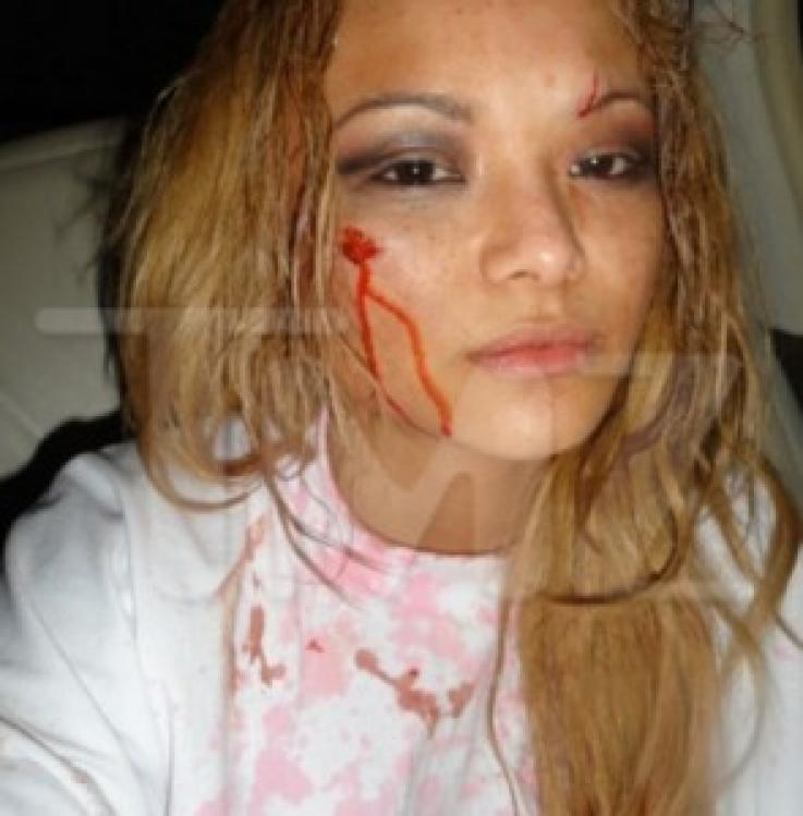 15037_tila_tequila_attacked_295x300_122_526lo.jpg